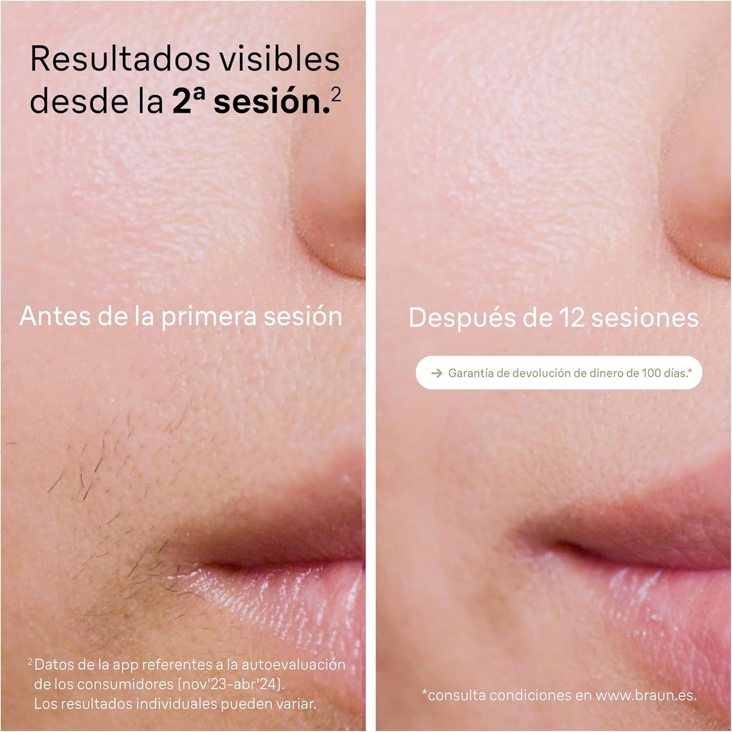 Depiladora IPL Braun Pro 5 PL5156 | A1126